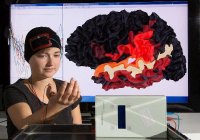 Bei der in Ilmenau entwickelten Methode werden die Hirnströme in Echtzeit gemessen und analysiert und von den gewonnenen Daten Parameter für eine elektrische Stimulation des Ge-hirns abgeleitet