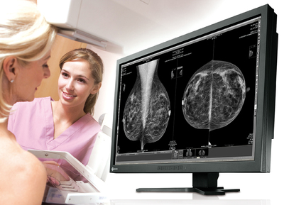 10 MP Mammography Monitor RadiForce GX1030