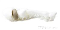 3D printed patient-specific finger implant out of PEEK