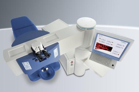 Der SCHWIND AMARIS : Modernster Augenlaser der Welt