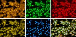 Credit : Broad Institute of MIT and Harvard. Human cells imaged using Cell Painting are treated with fluorescent dyes that mark different cellular components, including the nucleus, nucleoli, cytoplasmic RNA, Golgi, endoplasmic reticulum, mitochondria, actin cytoskeleton, and plasma membrane.