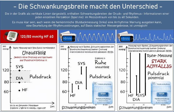 Die Schwankungsbreite macht den Unterschied