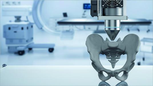 3D printing as a new feature in preoperative orthopedic planning.
