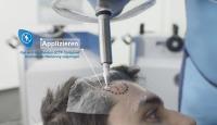Applikationstechnik OncoBeta