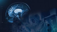EN und Sulfateq BV geben positive Ergebnisse aus ihrer Phase-1-Studie zum Prüfpräparat SUL-238 für die Behandlung der Alzheimer-Krankheit und anderer neurodegenerativer Erkrankungen bekannt