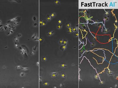 Save Time Using Automated Analysis of Chemotaxis Assays