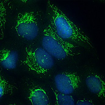 Mitochrondrien Netzwerk und Zellkern_Fluoreszenz-Mikroskopische Aufnahme.jpg