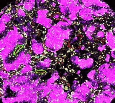 250912_LGG_immune_cells_c_R.Sigaud.jpg
