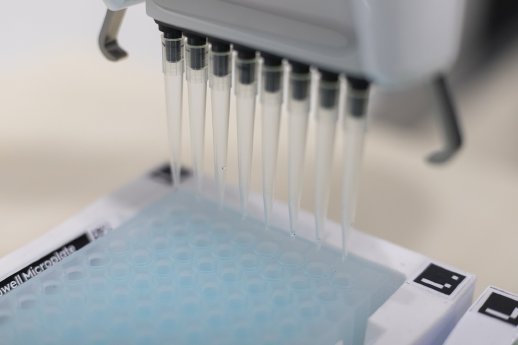anl_pr_2024_02_Weiterentwicklung_der_PFAS-Analytik.jpg