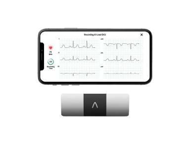 Produktbild KardiaMobile 6L mit Smartphone