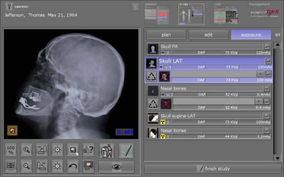 Preview of the X-ray image and worklist.jpg