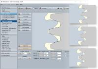 eAssistant cylindrical gear pair: Tooth form for different profile shifts