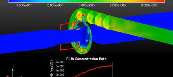 Ventricular Assist Device Flow