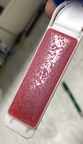 Produktionshygiene_für_ETL-_AnlagenDipSlide_Hefe_02.JPG