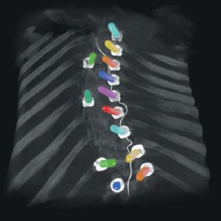 Enhanced Screw Visualization