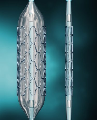 Stent.jpg