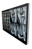 Canvys 4K Display 32