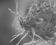 CeGaT aktualisiert Panel für Immundefekte
