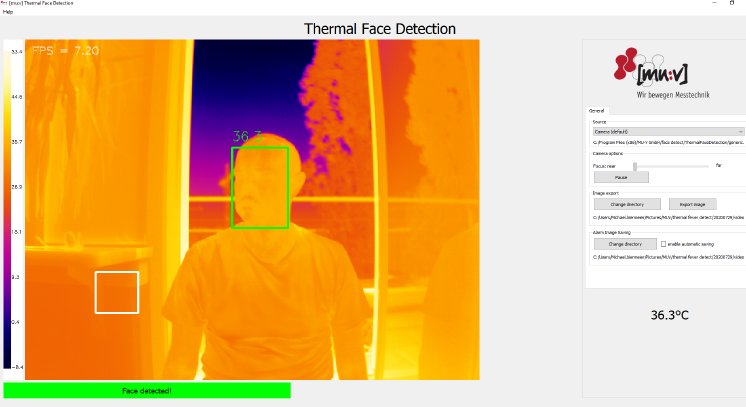 Thermal Face Detect.PNG