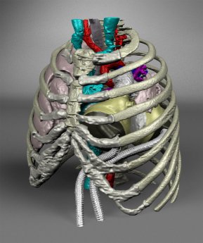 Total-Artificial-Heart_3D-Model.jpg