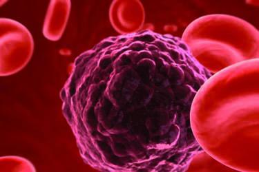 Circulating Tumor Cell