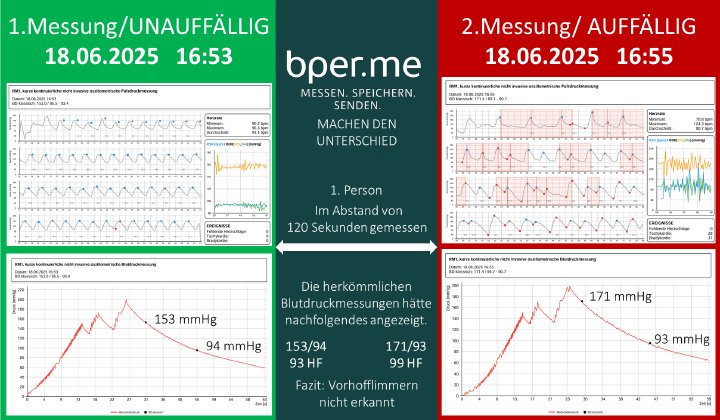 Blutdruckmessung mit System: Warum Vertrauen in die Blutdruckschwankung der erste Schritt ist