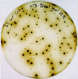 Metagenome Oxygenase.JPG