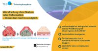 Gewebespezifisches ECM-Hydrogel-Hybridmaterial als passgenaues Implantat für die Behandlung umfangreicher Gewebsdefekte