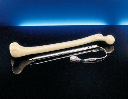 5_FITBONE WITTENSTEIN.jpg