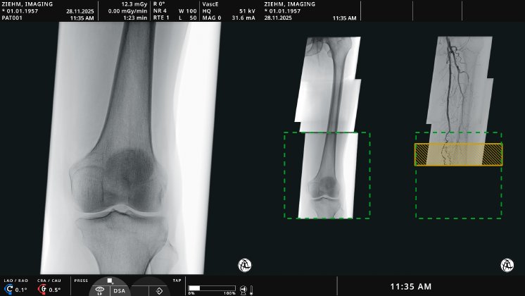 Zie-3438-Monitor fuer Animation_16-release_260220_6.png