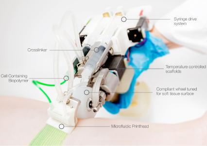 Gewinner "ReverTome Handheld Bioprinter" , Credit: Richard Cheng, University Toronto