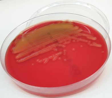 Streptococcus_catagoni_sp._nov._Bakterienkultur_Muehldorfer.jpg