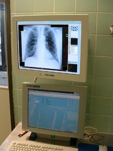 Matrox Extio RGU Krankenhaus Schwetzingen OP Displays