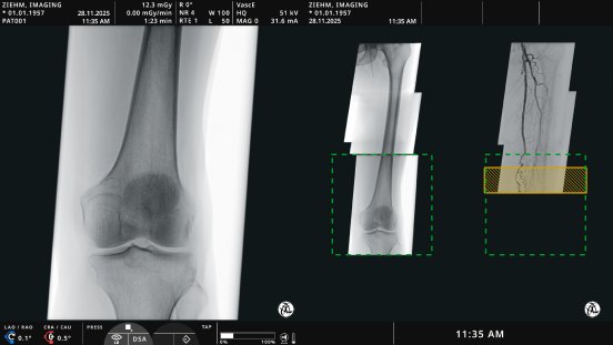 Zie-3438-Monitor fuer Animation_16-release_260220_6.png