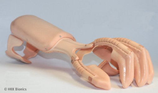exomition® hand one von HKK Bionics