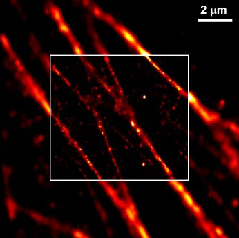 Actin staining of a fibroblast by phaloidin- Alexa647. The inset shows the structure super-.jpg