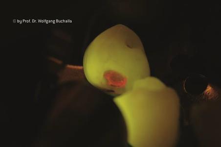 With Facelight