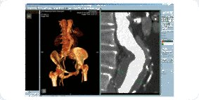 radiologen-und-operateure-profitieren-in-diagnostik-und-behandlung-von-3d-aufnahmen-b7[1].png