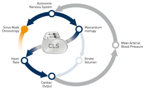 BIOTRONIK Announces Start of New Study Evaluating whether Pacemakers with Closed Loop Stimulation Prevent Reflex Syncope