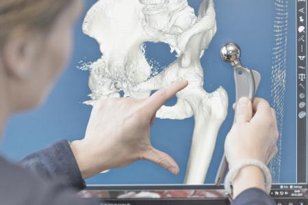 Der Blog der modiCAS GmbH bietet Wissenswertes und Spannendes zur Hüft- und Knieendoprothetik. Foto: modiCAS GmbH
