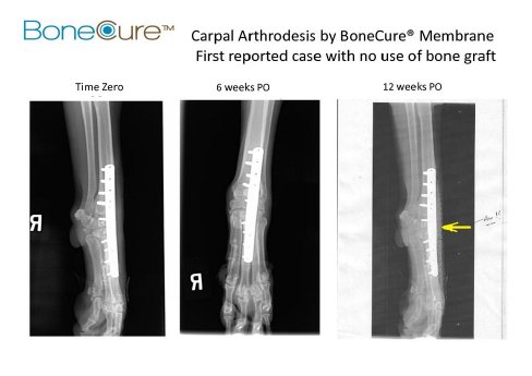 Case%20Study%204%20Carpal%20Arthrodesis(1).jpg