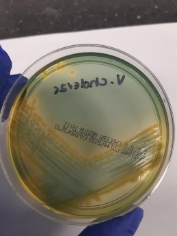 Vibrio testing 2.jpg