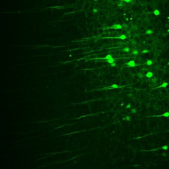 Two-photon imaging of GFP-labelled neurons_DZNE_Hans Fried.jpg