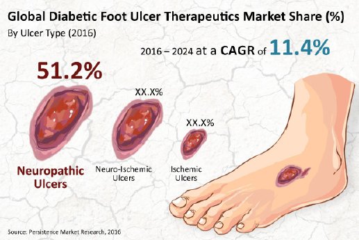 diabetic-foot-ulcer-therapeutics-market.jpg