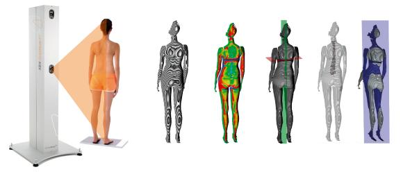 BodyMapper