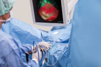 System blue - Das System für die Photodynamische Diagnostik (PDD)
