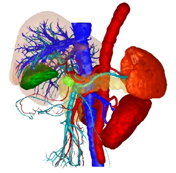 pancreas-tumor.jpg