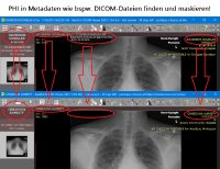 Die DarkShield-Basis-API wird für die Suche und Maskierung von unstrukturiertem Text außerhalb des Dateikontextes verwendet. Alternativ dazu bietet die DarkShield-Files-API die Möglichkeit, PII in Dateien zu suchen und zu maskieren.

Mit Hilfe der DarkShield-Files-API können halbstrukturierte und unstrukturierte Daten wie einfache Textdateien, CSV/TSV, HL7/X12, Word, Excel, PDF, JSON, XML, Parquet, BMP, GIF, JPG, PNG, TIF und DICOM-Bilder durchsucht und maskiert werden.