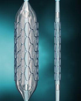 Stent.jpg
