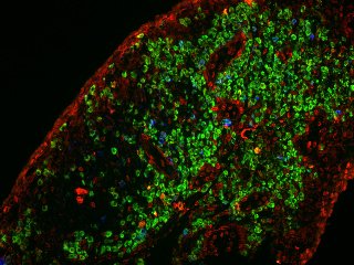 Immunzellen im Gewebe.jpg